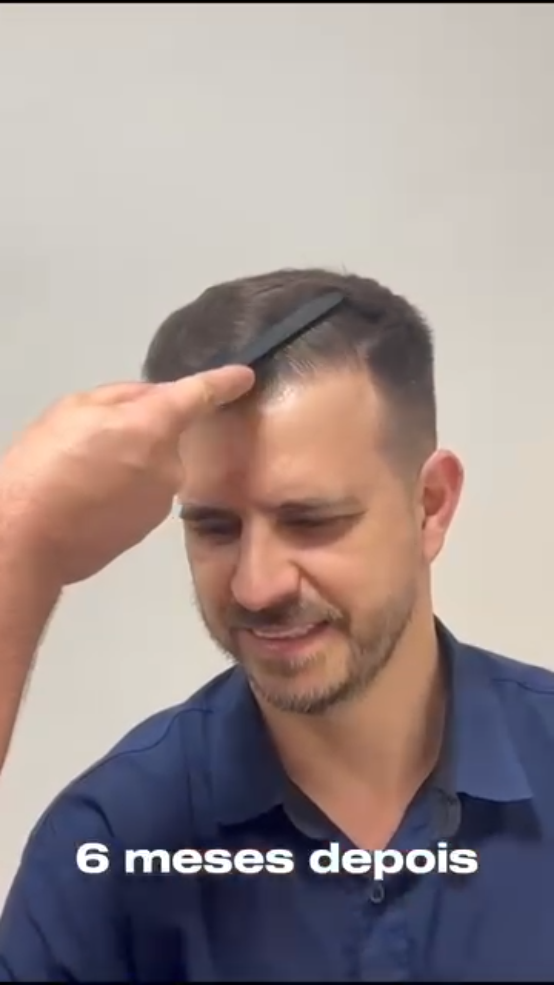 uploads/frames pro hair(3).png